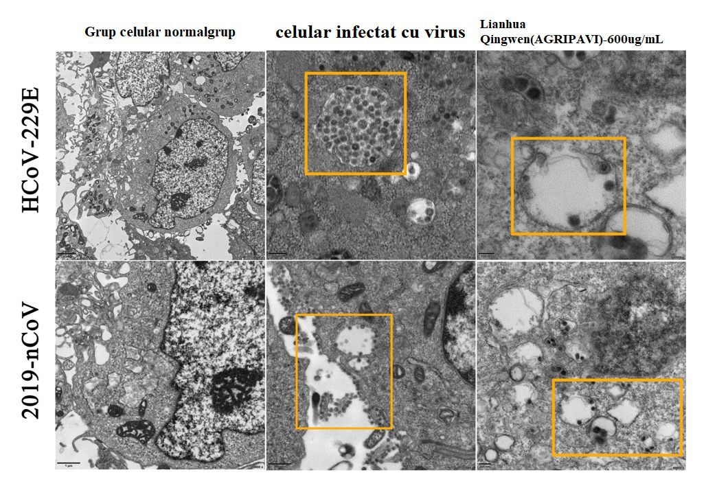 Micrografie AGRIPAVI inhiba celulele Vero E6 infectate cu COVID 19